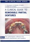 A Clinical Guide to Removable Partial Dentures