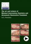 The art and science of Minimal Intervention Dentistry and Atraumatic Restorative Treatment
